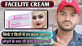 Facelite cream uses dose benefits and Side effects full review in hindi [upl. by Allred]