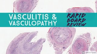 Dermpath Board Review Vasculitis amp Vasculopathy Dermpath Dermatology Pathology [upl. by Anifesoj]