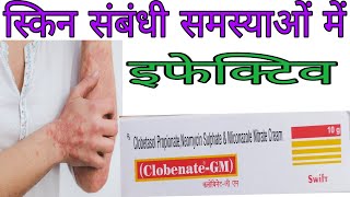 Clobenate  GM cream Uses and side effects in Hindi  क्लोबिनेट जी एम क्रीम की जानकारी [upl. by Delcine293]