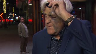 Jay Leno Gets Swollen Eye After Falling Down 60Foot Hill [upl. by Richma986]