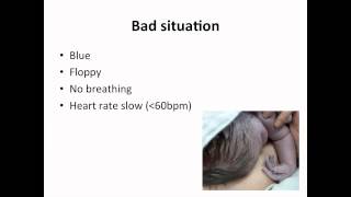 Paediatrics  neonatal resuscitation [upl. by Dnomayd]