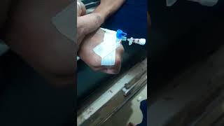 Iv cannulation insertion technique 👍 [upl. by Salim]