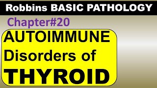 Ch20  Autoimmune Thyroid Pathology  Graves Disease  Hashimoto Robbins Pathology [upl. by Dunstan]