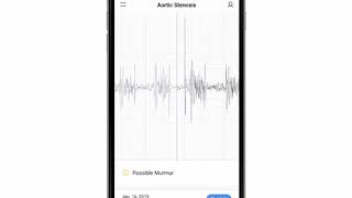 Aortic Stenosis Phonocardiogram  EkoCLINIC App [upl. by Nomla]