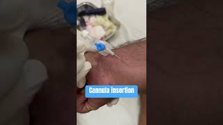 Cannula insertion of male patient cannulashortsnurses youtubeshorts ytshortssubscribe neet [upl. by Noni]