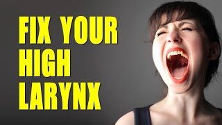 FIX A quotHIGH LARYNXquot NOW  Easy Vocal Tip  Singing Lesson NYC [upl. by Nidak]