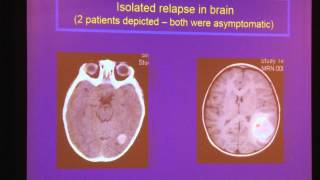 Dr Brian Kushner 2015 CNCF Conference [upl. by Ethelind]