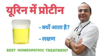 पेशाब में प्रोटीन । Protein in urine  Albumin in urine [upl. by Arlette]