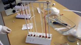 Erythrocyte sedimentation rate [upl. by Anuahsar]