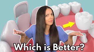 Dental Veneers vs Crowns  Which is Better amp Whats the Difference [upl. by Enived]