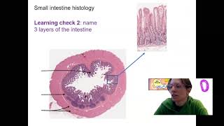 112 small intestine histology amp glands [upl. by Laban]