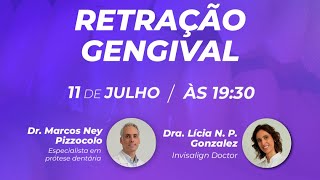 Retração Gengival  Raízes Expostas O que fazer [upl. by Mareld224]