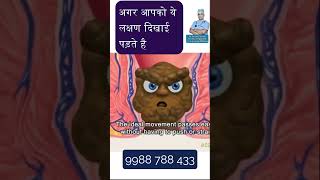 Fissure Treatment  fissure treatment in hindi  fissure treatment at home hindi shorts ytshorts [upl. by Aicelf]