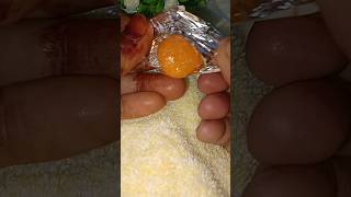 Vitamin C Candy 🍬shorts youtubeshorts trending chocolate candy food [upl. by Andrien]