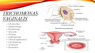 Trichomonas vaginalis [upl. by Assilaj428]