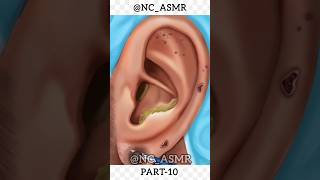 ASMR EAR CLEANING💢animation cartoon asmr [upl. by Noak]