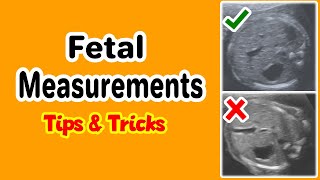 Fetal Measurements Tips and Tricks [upl. by Eliga]