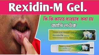 RexidinM Forte gel  residing m forte gel how to use  Residing m forte Reviews [upl. by Reklaw914]