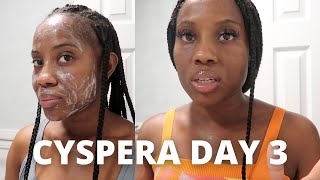 Cyspera Cysteamine Day 3  My Daily Melasma  Hyperpigmentation Skin Care Routine [upl. by Ojybbob]