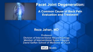 Facet Joint Degeneration A Common Cause of Back Pain Evaluation and Treatment [upl. by Odraner]