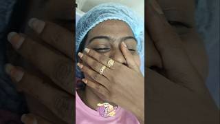 Advanced yellow peel skincare hydrafacialglow glutathioneiv chennai peeling [upl. by Jahn433]