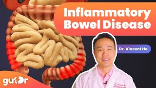 Inflammatory Bowel Disease IBD  The GutDr Explains 3D Gut Animation [upl. by Leumek916]