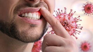 SDLE microorganisms منال نوتز saudi dental licensure examination [upl. by Nabi]