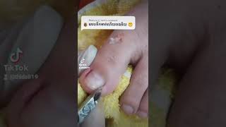 How to use a cuticle nipper nail​​​ nailart fyp ear shorts viral wax blackheads [upl. by Gavra]