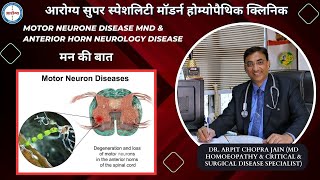 Motor Neuron DiseaseMND amp Anterior Horn Neurology Disease by Dr Arpit Chopra Jain [upl. by Ellebyam]