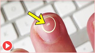 How To Get Rid Of White Spots On Nails Within 7 Days  Nail Treatments [upl. by Mcwilliams968]