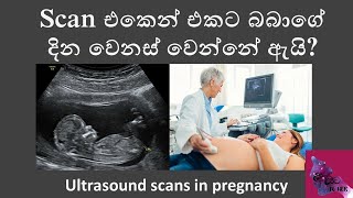 Scan එකෙන් එකට බබාගේ දින වෙනස් වෙන්නේ ඇයි [upl. by Truelove]