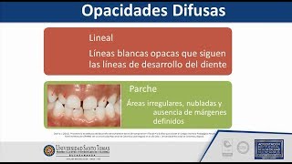 Defectos de Desarrollo del Esmalte USTABuca [upl. by Bibby540]