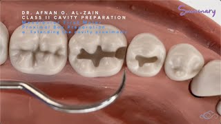 Class II cavity preparation for amalgam  mandibular molar 36  Preclinical Operative  Arabic عربي [upl. by Duwe]