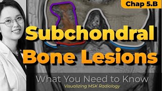 Chapter 5 B⎜Subchondral bone lesions ⎜Knee MRI⎜Visualizing MSK Radiology⎜Refer to timeline [upl. by Croft562]