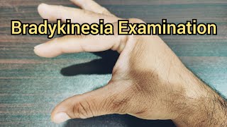 How to Examine a Patient for Bradykinesia  Parkinsonism [upl. by Llenrag]