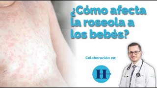 ¿Qué es la roseola y cómo puede afectar a tu bebé • Dr Manuel Lavariega [upl. by Bartlet]