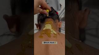 Remove dead skin in minutes  suntan removal hom remedy shorts youtube deadskin [upl. by Boyer595]