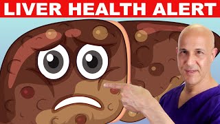 Avoid 1 Food Thats Making Your LIVER Sick Dr Mandell [upl. by Ahsilac979]