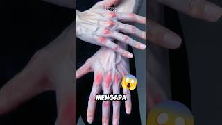 TANGANNYA kenapa begitu hands veins 😱‼️ shorts Logikanya facts [upl. by Llenej]