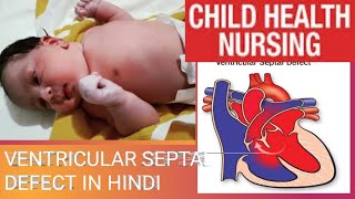 Ventricular Septal Defect in hindi by Asha medical classes bsc nursing 6th semester [upl. by Knowlton]