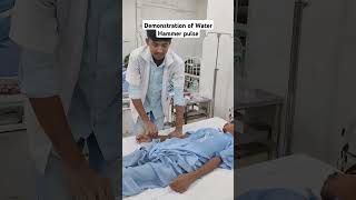 Demonstration of Water Hammer Pulse  In Aortic Regurgitation medical medicine doctor [upl. by Suedama]