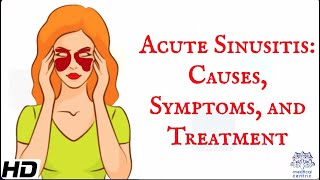 Acute sinusitis  Everything you need to know [upl. by Golden913]