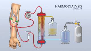 HAEMODIALYSIS DIALYZER [upl. by Amatruda475]