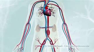 CIRURGIA ENDOVASCULAR DE ANEURISMA DA AORTA ABDOMINAL [upl. by Mena7]