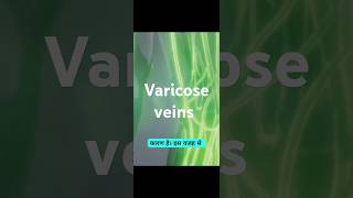 Varicose veinsmedicine healthtipshealth healthcaresymptoms treatmentvaricosevein [upl. by Yran52]