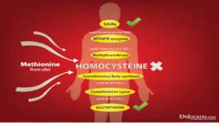 Hyperhomocysteinemia [upl. by Ynaffi]