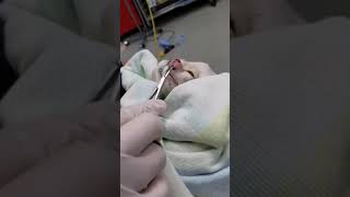 save a cats life ❤️💔 Removing a cuterebra from a little cat [upl. by Pet]