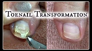 Pedicure Tutorial Toenail Transformation and Time Saving Tips ✔ [upl. by Bodkin412]