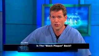 Man survives Black Death after contracting Bubonic Plague in Oregon USA [upl. by Stutman728]