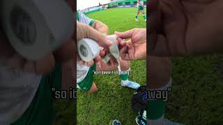 Finger Injury Pov 📹☝️ [upl. by Nylecaj]